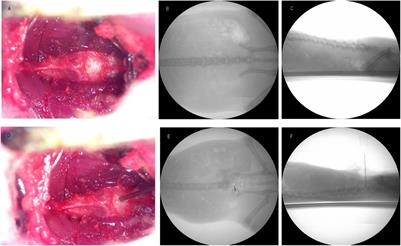 The Effect and Possible Mechanism of Intradiscal Injection of Simvastatin in the Treatment of Discogenic Pain in Rats